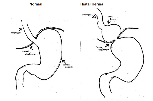 stomach