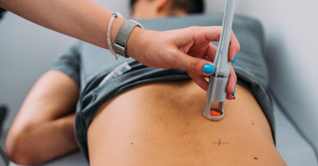 Cold Laser Therapy